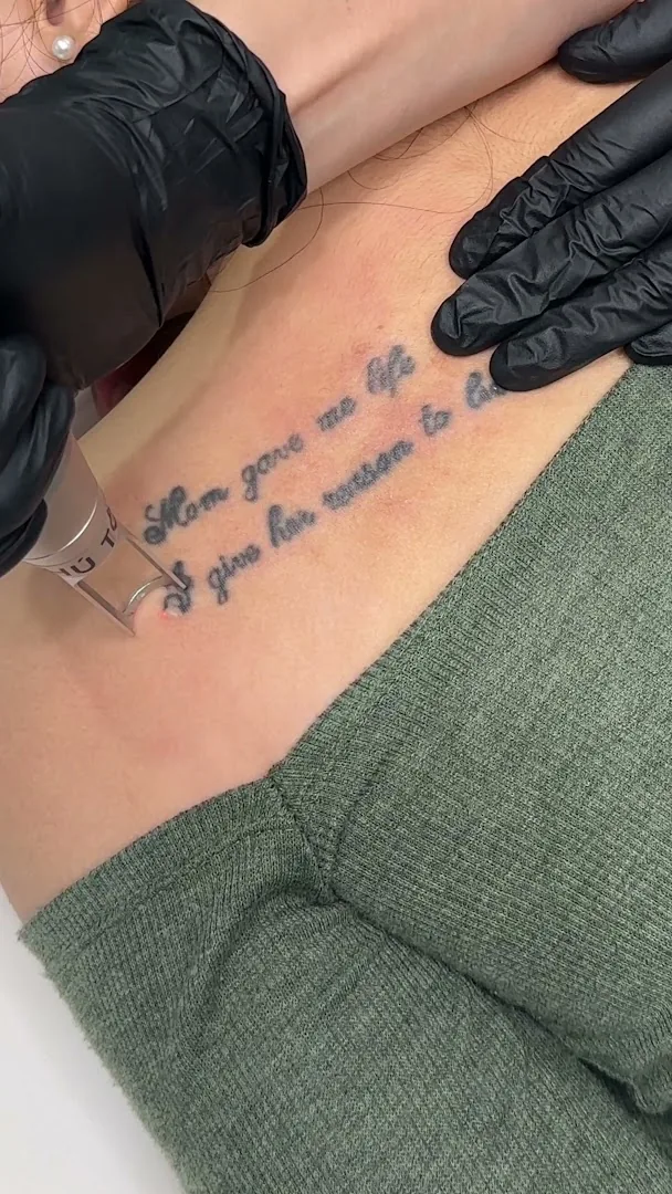 Phú Tôn - Laser Tattoo Removal