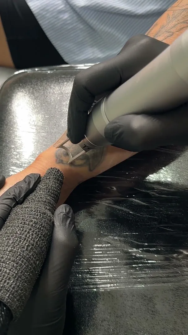 Phú Tôn - Laser Tattoo Removal
