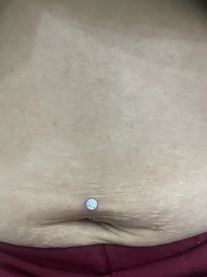 Nâu xỏ khuyên piercing professional Đà Nẵng